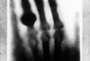 Spinning off basic research: Computed Tomography